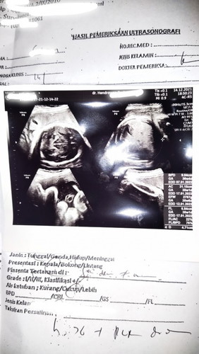 KU KIRA CIRI JANIN MASUK PANGGUL, TERNYATA PLACENTA PREVIA