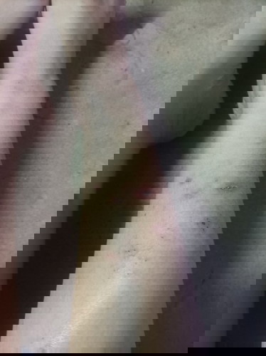 มีแม่ท่านไหนเป็นบ้างคะ