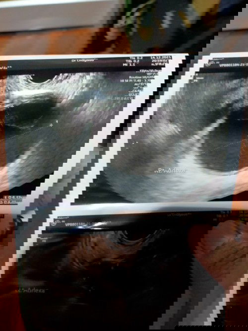 ไปหาหมอมาค่ะ