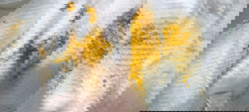 Normal lang po ba ganito poops ni baby