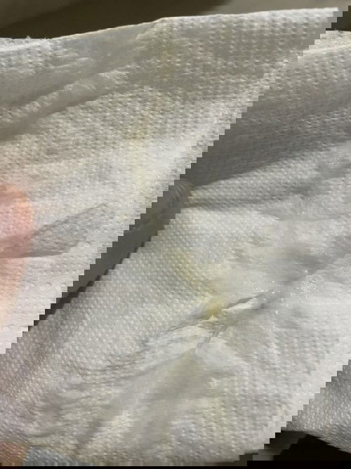 แบบนี้ใช่หมูกหรือป่าวค่ะ
36w 3