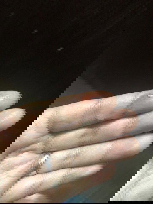 แบบนี้คือมูกเลือดไหม