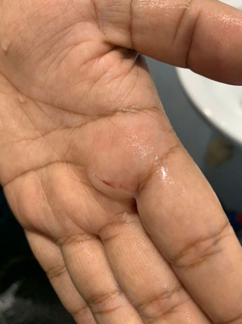 Tolongggg, Darah apa nie