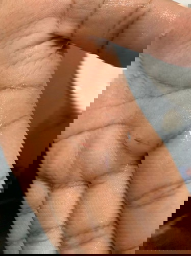 Tolongggg, Darah apa nie