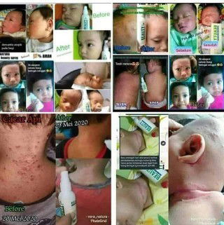 Numpang lapak ya Bun