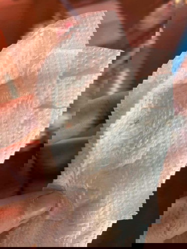 ครรภ์ 36 วีค มีเลือดออกมานิดหน่อย