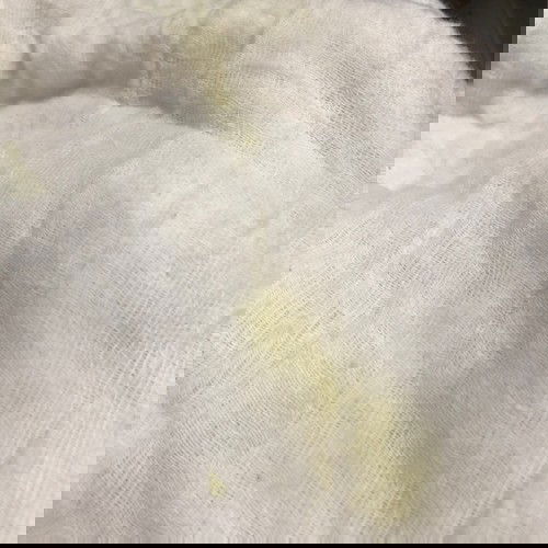 Yellow vomit
