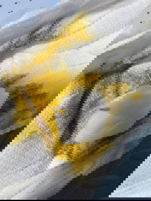 แบบไหนถึงเรียกว่าถ่ายปนมูกคะ น้องถ่ายแบบนี้เรียกว่าปนมูกมั้ยคะ แล้วปกติมั้ยคะแม่ๆ ไม่มีเลือดปนค่ะ น้อง 6 เดือน 22 วันค่ะ เริ่มทานอาหารแล้วค่ะ