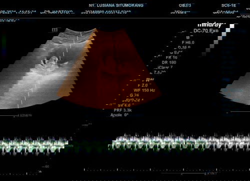 Apakah aman olahraga pake gymball di hamil 29 minggu?