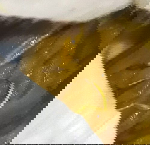 แบบนี้ใช่พยาธิหรือเปล่าคะ