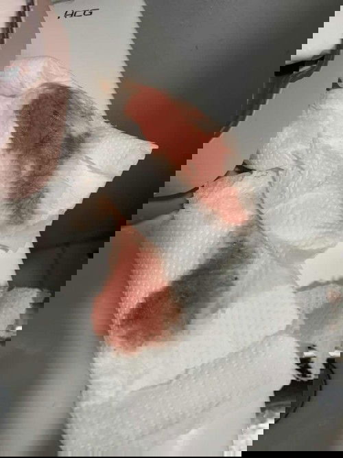 Miscarriage po ba ito?