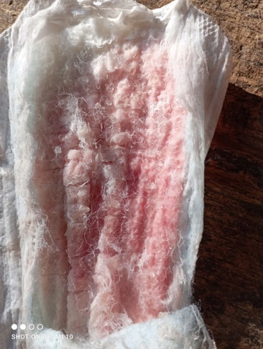 สอบถามหน่อยค่ะ ท้อง39W