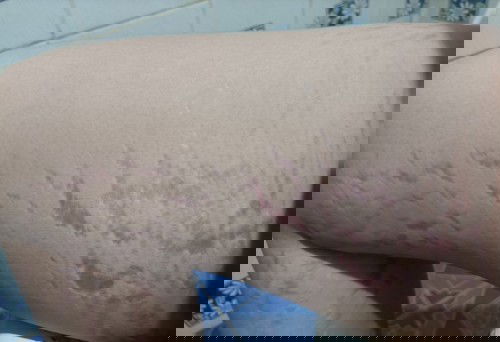 แตกลายอะไรขนาดนี้