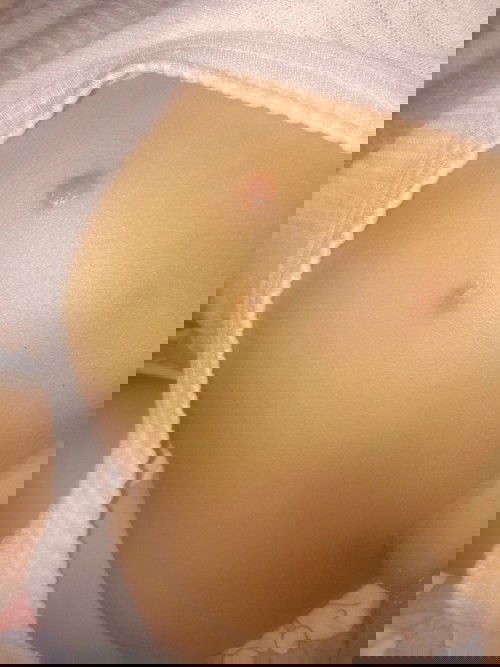 Benjolan seperti bisul