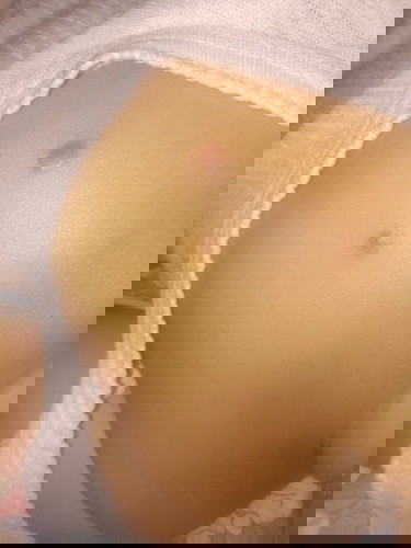 Benjolan seperti bisul