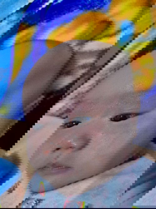 Ruam susu atau alergi