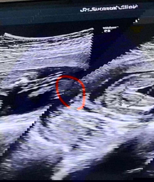 สอบถามแม่ๆหน่อยค่ะ