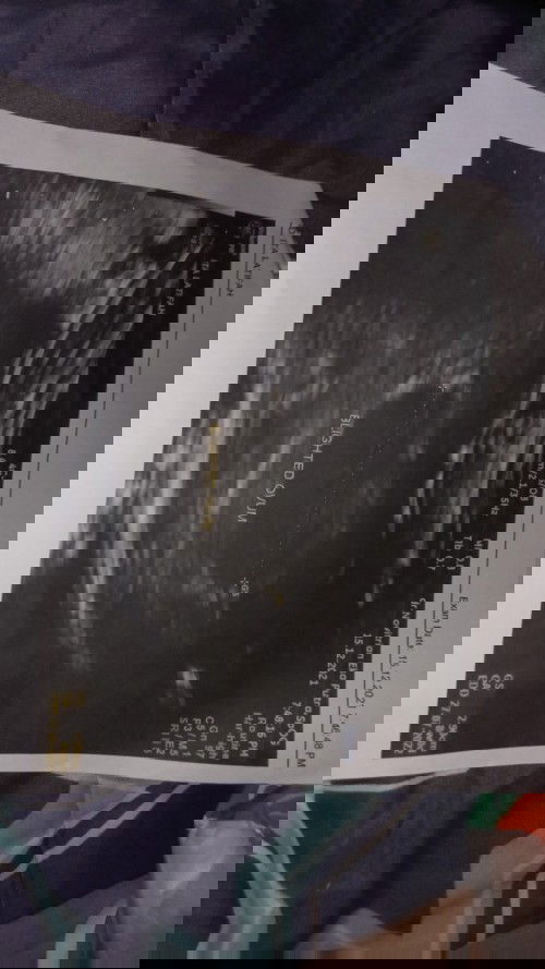 dinyatakan hamil kosong dan janin tidak berkembang