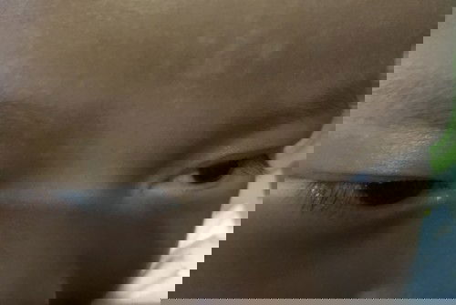 Putih putih di kulit