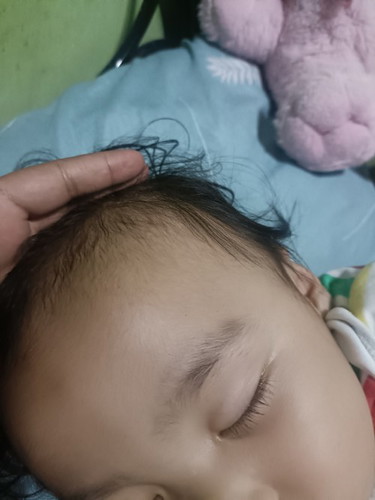My bukol si bunso