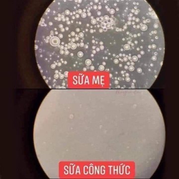 ???SỮA MẸ CÓ THỰC SỰ TỐT???