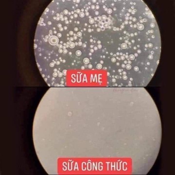 ???SỮA MẸ CÓ THỰC SỰ TỐT???