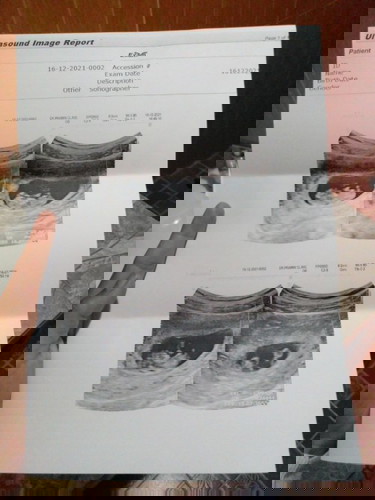 ท้องแรก
9week 4day ดิ้นให้แม่ดูแล้ว