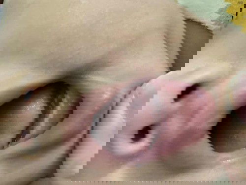 apa ini tumbuh gigi?