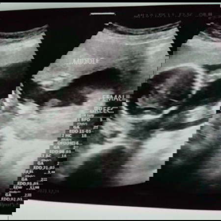 ผู้หญิงหรือผู้ชายคะใครดูเป็นช่วยดูหน่อยค่ะ..