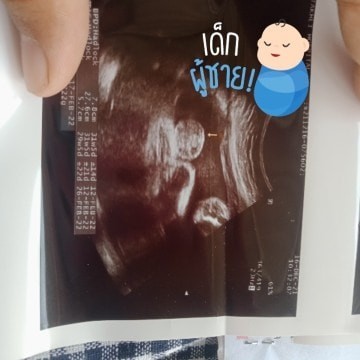 รู้เพศกันยังค่ะแม่ๆ