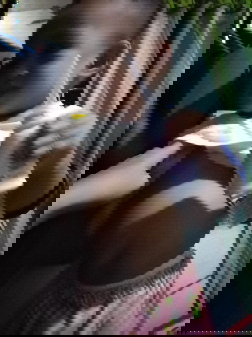 Malaki ang tyan ni baby. Normal lang po ba tong ganito kalaki?