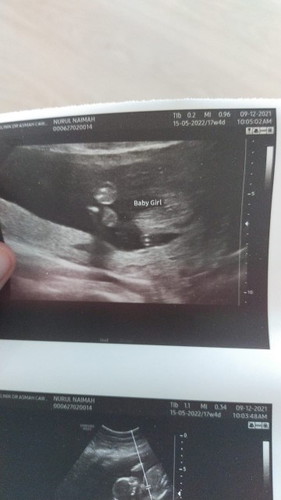 Gender baby