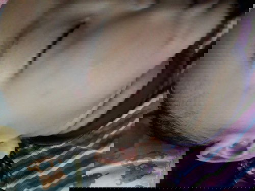 Badan dan wajah merah merah