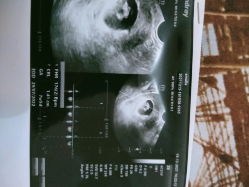 Bunda aku hamil masuk 8minggu1hari,jika mau usg yang ketauan jenis kelamin nyadi usia kandungan brp