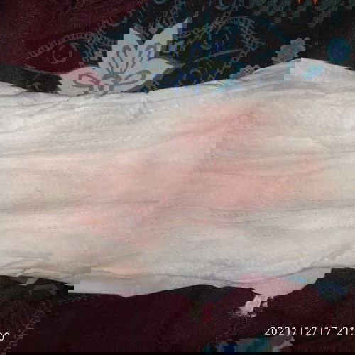 Hamil 35 minggu keluar darah