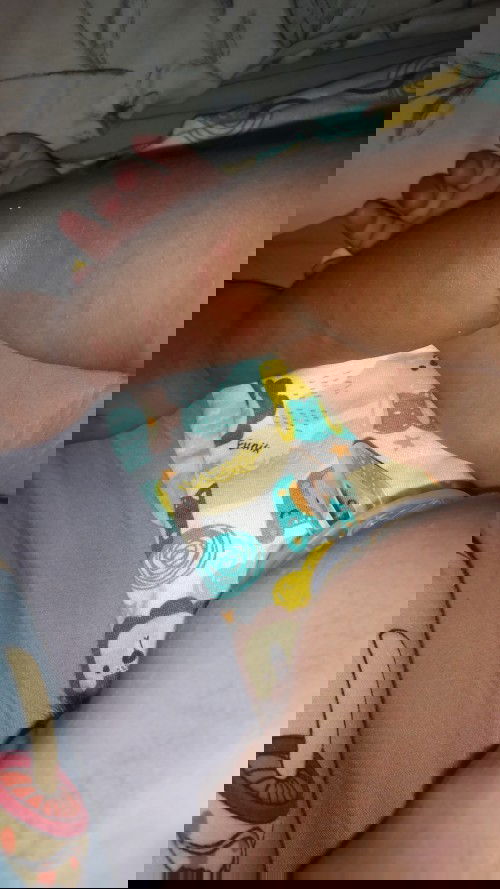 Biji biji merah pada kulit bayi