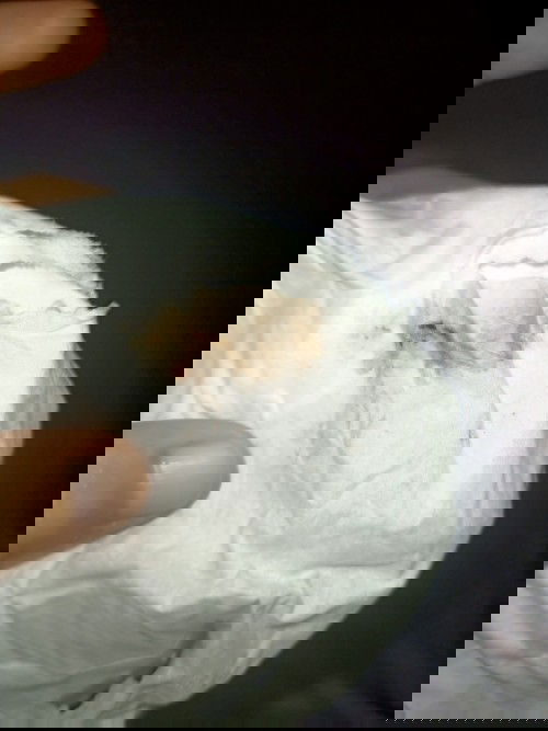 Flek lagi di kehamilan 7 minggu