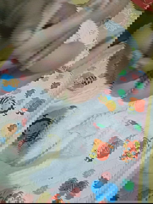 Bayi sembelit, dan pupnya warnanya kuning pucet mendekati hijau