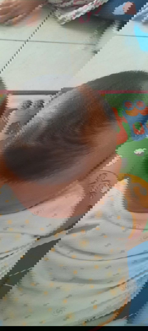 Rambut anak tumbuh tidak rata