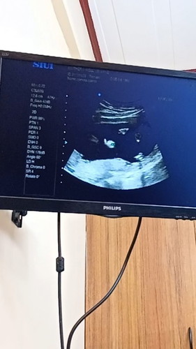 My Baby waving in my Tummy