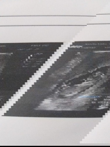 สอบถามหน่อยจ้า ขอความคิดเห็นหน่อยค่ะ