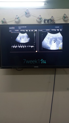 ท้องได้7วีค
