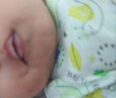 Bibir bayi seperti ada lapisan putih,,,,,,Apa penyebabnya dan bagaimana mengatasinya bun ???????????