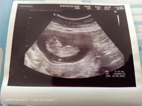 มาอัพเดตนะคะ