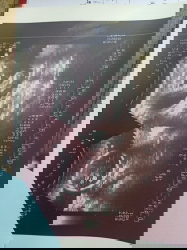 แม่ๆดูออกไม่ค่ะ ว่า ผู้หญิง หรือ ผู้ชาย ทีมเมษายน65 ซาวด์ตอน20สัปดาห์ค่ะ