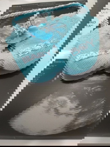 Baby boy @27 weeks