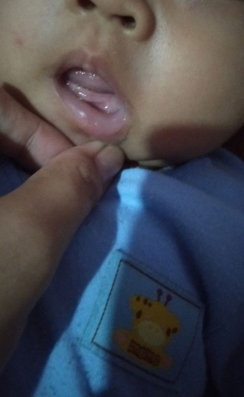 Tumbuh gigi atau bukan ?