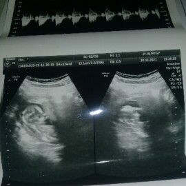 Hamil 15 minggu perut belum membesar