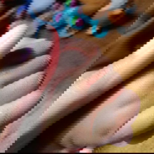 Permasalahan kulit bayi