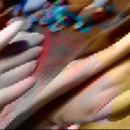 Permasalahan kulit bayi